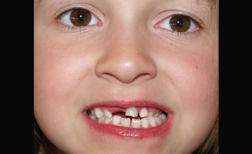 چگونه  فرزندانمان دندان شیری سالمی داشته باشند؟