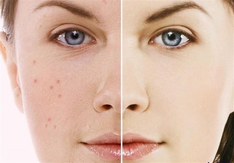 مراقبت از پوست در برابر آلودگی هوا
