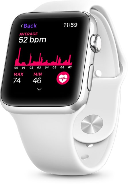 ساعت اپل بیماری‌های قلبی راتشخیص می‌دهد؟