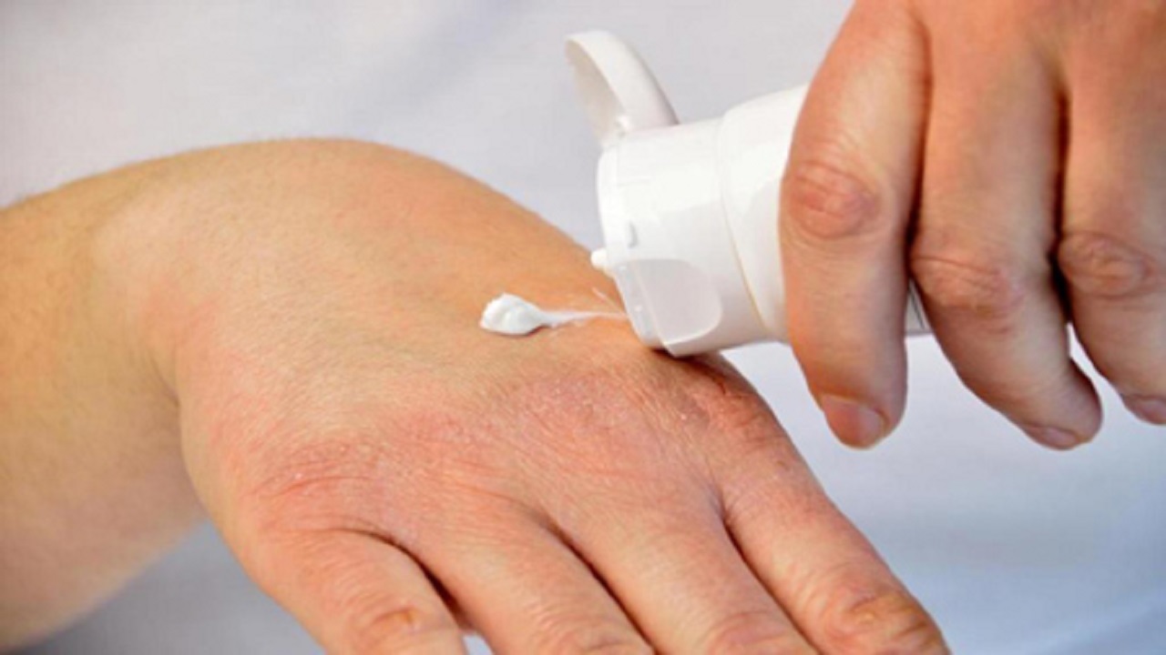 درمان خشکی پوست دست با این روش
