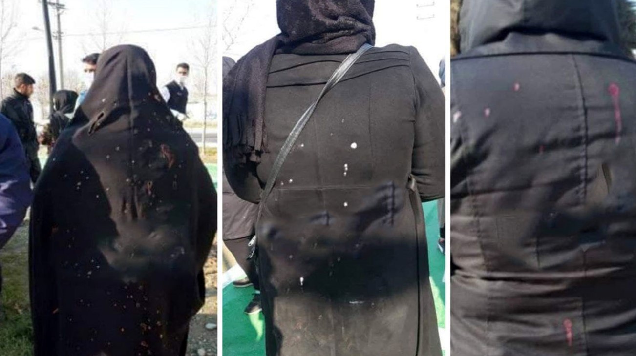 اسیدپاشی وحشتناک به زنان تهرانی در شهرک مریم + عکس